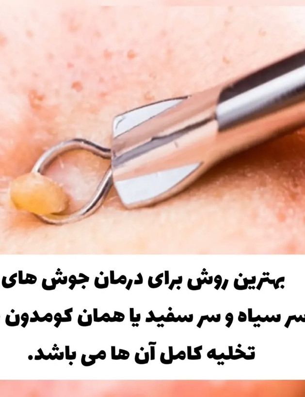 میله پیلینگ تخلیه جوش فلزی